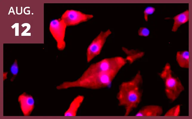 Diagram of pediatric brain tumor cells with text 