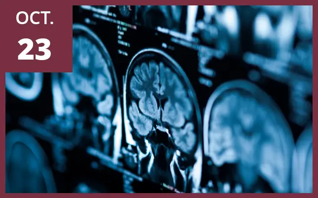 Brain scan diagram with the text 