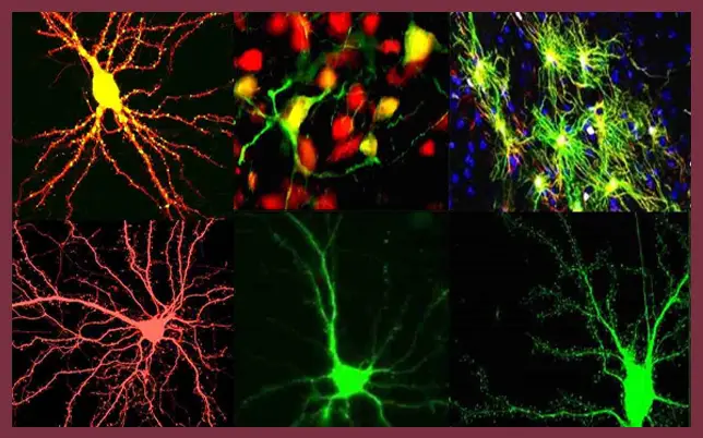 A six-panel collage of microscopic images showing neurons and glial cells in various fluorescent colors, including vibrant yellow, red, and green, set against a dark background and framed by a maroon border.